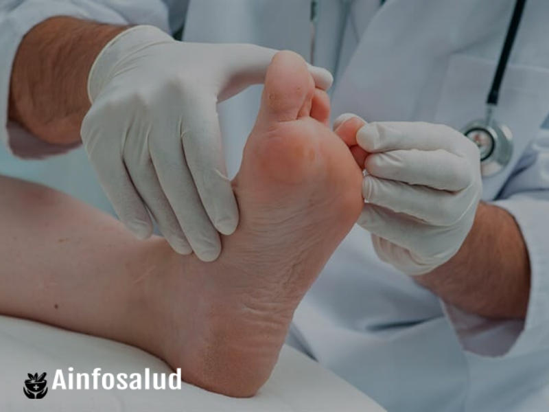 Tratamientos naturales para dolor de pies y heridas en diabeticos